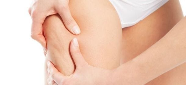 Tenica lipodissolve: il metodo dolce contro la cellulite