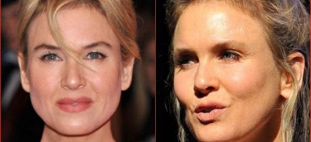 Renée Zellweger, irriconoscibile a causa del (troppo) botulino