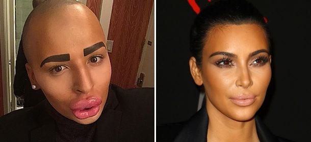 Kim Kardashian: uomo spende più di 100 mila euro in chirurgia per assomigliarle