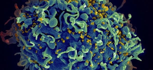 Hiv, una pillola preventiva per ridurre le infezioni