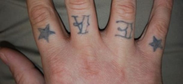 Rimuovere un tatuaggio: 10 cose da sapere