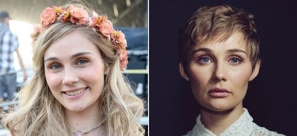 Tumori: l'attrice Clare Bowen sensibilizza sugli effetti collaterali della chemio. "Sono solo capelli"