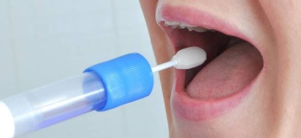 Tumori, diagnosi veloce dalla saliva. Il nuovo test è una biopsia liquida