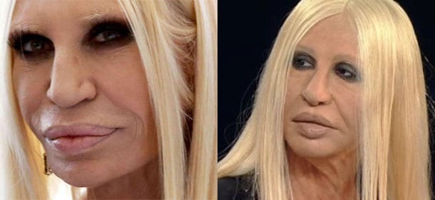 Sanremo 2016: Virginia Raffaele imita Donatella Versace e ironizza sugli eccessi della chirurgia estetica