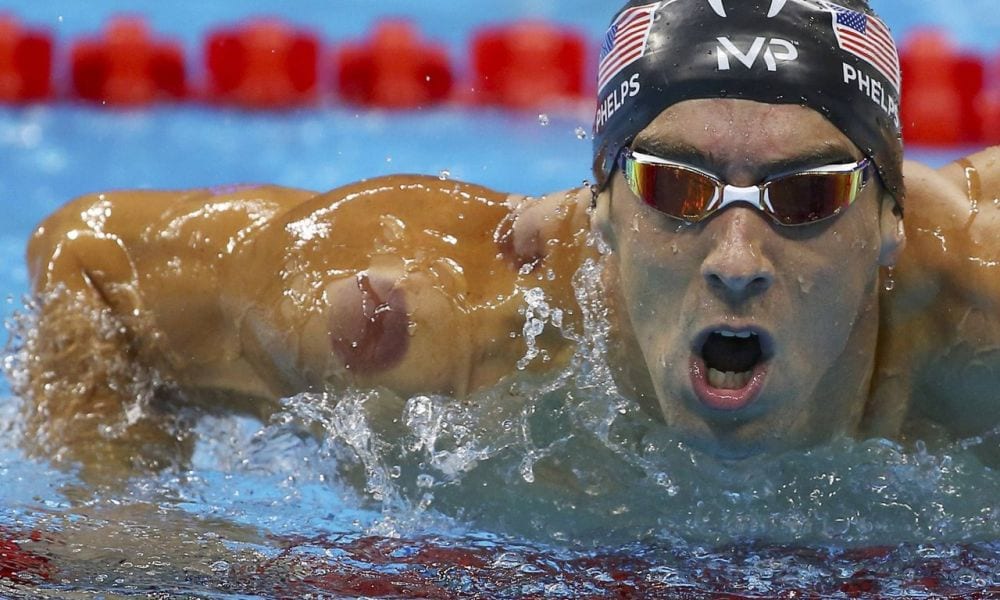 Il cupping di Phelps, Naddour e le star di Hollywood. Quali benefici?